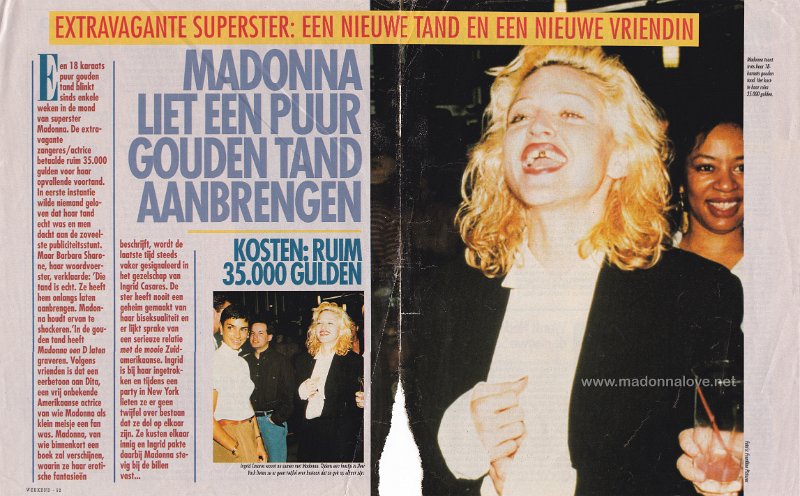 1992 - Unknown month - Weekend - Holland - Madonna liet een puur gouden tand aanbrengen
